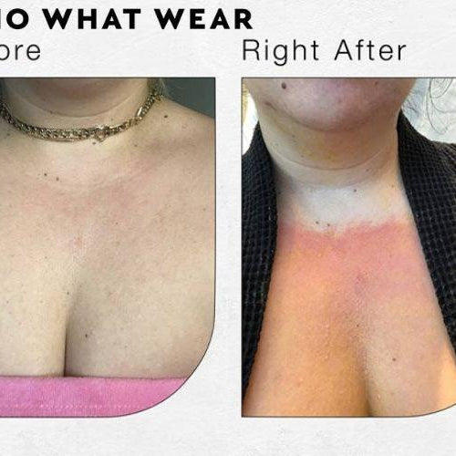 This Is What I Did to Undo the Years of Sun Damage on My Cleavage - Emerage Cosmetics